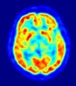 Weirdest Things Your Brain Does — Starz Psychics spiritual blog, psychic insights